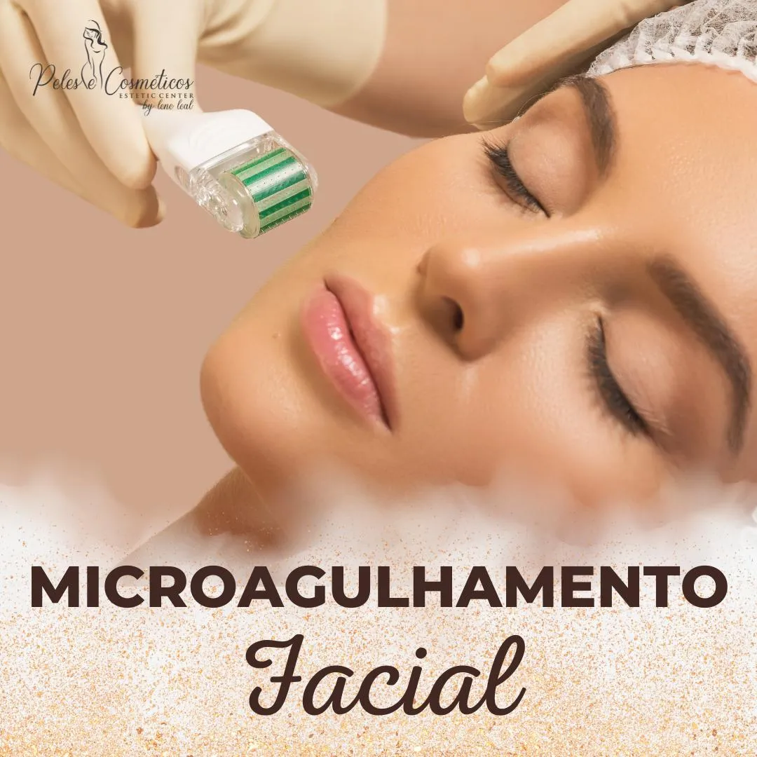 microagulhamento-facial