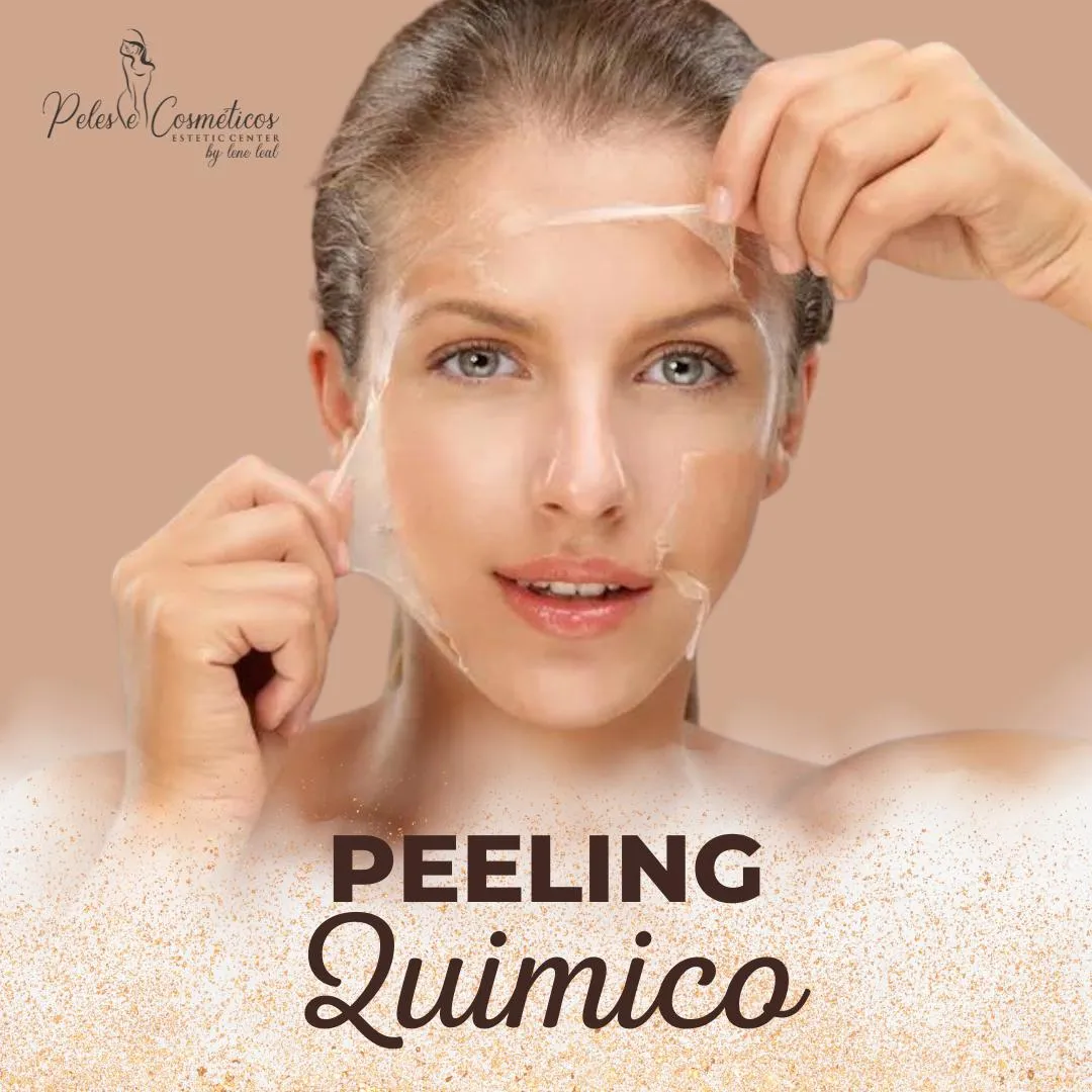 peeling-quimico